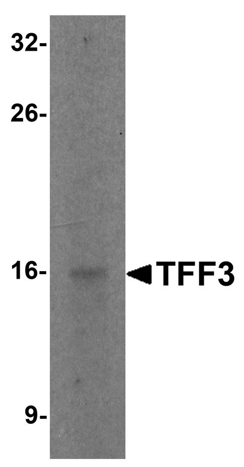 TFF3 / Trefoil Factor 3 Antibody - Western blot analysis of TFF3 in rat small intestine tissue lysate with TFF3 antibody at 2 ug/ml.