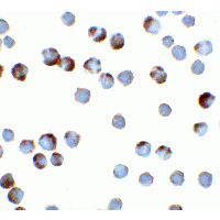 TFF3 / Trefoil Factor 3 Antibody - Immunocytochemistry of TFF3 in HeLa cells with TFF3 antibody at 2 µg/ml.