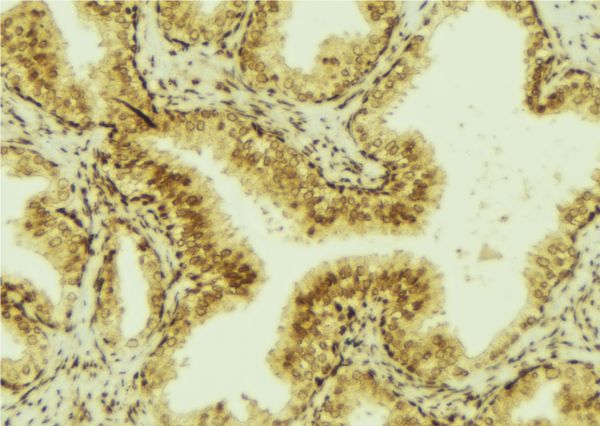 TFF3 / Trefoil Factor 3 Antibody - 1:100 staining mouse colon tissue by IHC-P. The sample was formaldehyde fixed and a heat mediated antigen retrieval step in citrate buffer was performed. The sample was then blocked and incubated with the antibody for 1.5 hours at 22°C. An HRP conjugated goat anti-rabbit antibody was used as the secondary.