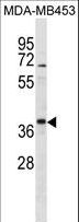 TFG Antibody - TFG Antibody western blot of MDA-MB453 cell line lysates (35 ug/lane). The TFG antibody detected the TFG protein (arrow).
