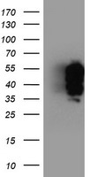 TFG Antibody - HEK293T cells were transfected with the pCMV6-ENTRY control (Left lane) or pCMV6-ENTRY TFG (Right lane) cDNA for 48 hrs and lysed. Equivalent amounts of cell lysates (5 ug per lane) were separated by SDS-PAGE and immunoblotted with anti-TFG.