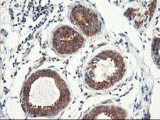 TFG Antibody - IHC of paraffin-embedded Human breast tissue using anti-TFG mouse monoclonal antibody.