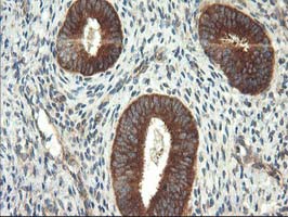TFG Antibody - IHC of paraffin-embedded Human endometrium tissue using anti-TFG mouse monoclonal antibody.