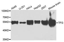 TFG Antibody - Western blot analysis of extracts of various cells.