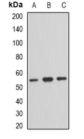 TFG Antibody - Western blot analysis of TFG expression in HeLa (A); HepG2 (B); mouse brain (C) whole cell lysates.