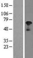 TFG Protein - Western validation with an anti-DDK antibody * L: Control HEK293 lysate R: Over-expression lysate
