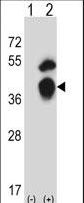 TFIIB Antibody - Western blot of GTF2B (arrow) using rabbit polyclonal GTF2B Antibody. 293 cell lysates (2 ug/lane) either nontransfected (Lane 1) or transiently transfected (Lane 2) with the GTF2B gene.