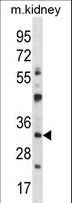 TFIIB Antibody - GTF2B Antibody western blot of mouse kidney tissue lysates (35 ug/lane). The GTF2B antibody detected the GTF2B protein (arrow).