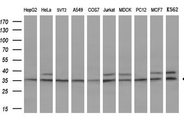 TFIIB Antibody - Western blot analysis of extracts. (10ug) from 10 different cell lines by using anti-GTF2B monoclonal antibody. (1:200)