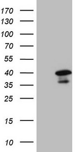 TFIIB Antibody - HEK293T cells were transfected with the pCMV6-ENTRY control. (Left lane) or pCMV6-ENTRY GTF2B. (Right lane) cDNA for 48 hrs and lysed. Equivalent amounts of cell lysates. (5 ug per lane) were separated by SDS-PAGE and immunoblotted with anti-GTF2B. (1:2000)