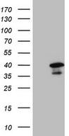 TFIIB Antibody - HEK293T cells were transfected with the pCMV6-ENTRY control. (Left lane) or pCMV6-ENTRY GTF2B. (Right lane) cDNA for 48 hrs and lysed