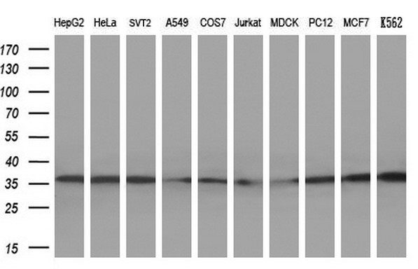TFIIB Antibody - Western blot analysis of extracts. (10ug) from 10 different cell lines by using anti-GTF2B monoclonal antibody. (1:2000)
