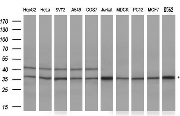 TFIIB Antibody - Western blot analysis of extracts. (10ug) from 10 different cell lines by using anti-GTF2B monoclonal antibody. (1:200)