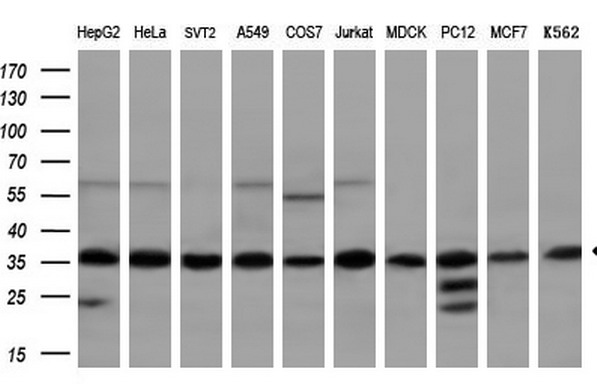 TFIIB Antibody - Western blot analysis of extracts. (10ug) from 10 different cell lines by using anti-GTF2B monoclonal antibody. (1:200)