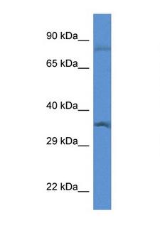TFIIB Antibody - GTF2B / TFIIB antibody Western blot of Rat Lung lysate. Antibody concentration 1 ug/ml.  This image was taken for the unconjugated form of this product. Other forms have not been tested.