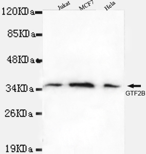 TFIIB Antibody - Western blot detection of TFIIB in Jurkat,MCF7&Hela cell lysates using TFIIB antibody (1:1000 diluted).