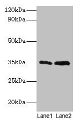TFIIB Antibody - Western blot All lanes: Transcription initiation factor IIB antibody at 2µg/ml Lane 1: HepG2 whole cell lysate Lane 2: Hela whole cell lysate Secondary Goat polyclonal to rabbit IgG at 1/15000 dilution Predicted band size: 35 kDa Observed band size: 35 kDa