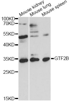 TFIIB Antibody - Western blot analysis of extracts of various cell lines, using GTF2B antibody at 1:1000 dilution. The secondary antibody used was an HRP Goat Anti-Rabbit IgG (H+L) at 1:10000 dilution. Lysates were loaded 25ug per lane and 3% nonfat dry milk in TBST was used for blocking. An ECL Kit was used for detection and the exposure time was 30s.
