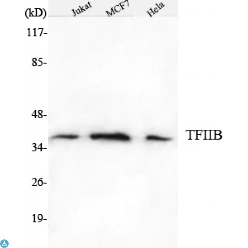 TFIIB Antibody - Western Blot (WB) analysis using TFIIB Monoclonal Antibody against Jurkat, MCF7, HeLa cell lysate.