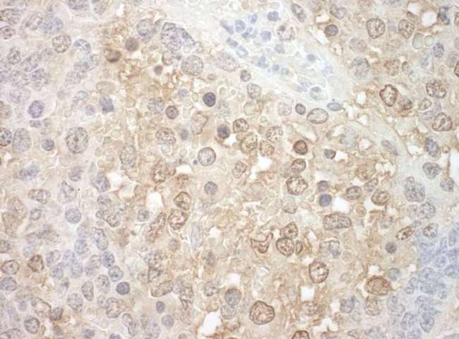 TFIP11 Antibody - Detection of Mouse TFIP11 by Immunohistochemistry. Sample: FFPE section of mouse teratoma. Antibody: Affinity purified rabbit anti-TFIP11 used at a dilution of 1:250.