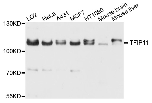 TFIP11 Antibody - Western blot analysis of extract of various cells.