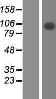 TFIP11 Protein - Western validation with an anti-DDK antibody * L: Control HEK293 lysate R: Over-expression lysate