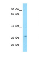 TFPI / LACI Antibody - TFPI antibody Western blot of 721_B Cell lysate. Antibody concentration 1 ug/ml.  This image was taken for the unconjugated form of this product. Other forms have not been tested.