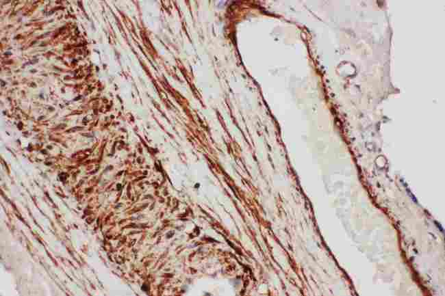 TFPI / LACI Antibody - Immunohistochemistry - Anti-TFPI Antibody