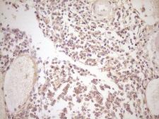 TFPI / LACI Antibody - Immunohistochemical staining of paraffin-embedded Human thyroid tissue within the normal limits using anti-TFPI mouse monoclonal antibody. (Heat-induced epitope retrieval by 1 mM EDTA in 10mM Tris, pH8.5, 120C for 3min,