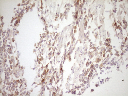 TFPI / LACI Antibody - Immunohistochemical staining of paraffin-embedded Human colon tissue within the normal limits using anti-TFPI mouse monoclonal antibody. (Heat-induced epitope retrieval by 1 mM EDTA in 10mM Tris, pH8.5, 120C for 3min,