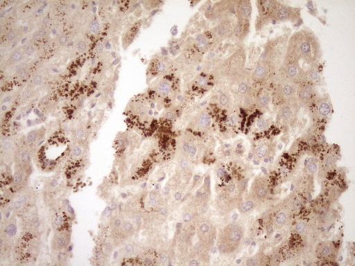 TFPI / LACI Antibody - IHC of paraffin-embedded Human liver tissue using anti-TFPI mouse monoclonal antibody. (Heat-induced epitope retrieval by 1 mM EDTA in 10mM Tris, pH8.5, 120°C for 3min).