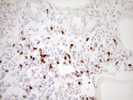 TFPI / LACI Antibody - Immunohistochemical staining of paraffin-embedded Human thyroid tissue within the normal limits using anti-TFPI mouse monoclonal antibody. (Heat-induced epitope retrieval by 1 mM EDTA in 10mM Tris, pH8.5, 120C for 3min,