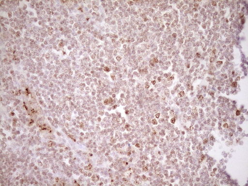 TFPI / LACI Antibody - Immunohistochemical staining of paraffin-embedded Human tonsil within the normal limits using anti-TFPI mouse monoclonal antibody. (Heat-induced epitope retrieval by 1 mM EDTA in 10mM Tris, pH8.5, 120C for 3min,