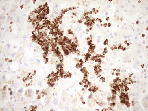 TFPI / LACI Antibody - Immunohistochemical staining of paraffin-embedded Human liver tissue within the normal limits using anti-TFPI mouse monoclonal antibody. (Heat-induced epitope retrieval by 1 mM EDTA in 10mM Tris, pH8.5, 120C for 3min,