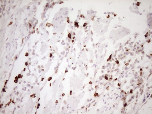 TFPI / LACI Antibody - IHC of paraffin-embedded Human colon tissue using anti-TFPI mouse monoclonal antibody. (Heat-induced epitope retrieval by 1 mM EDTA in 10mM Tris, pH8.5, 120°C for 3min).
