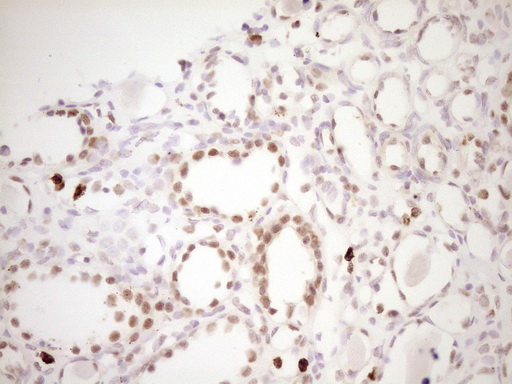 TFPI / LACI Antibody - IHC of paraffin-embedded Human Kidney tissue using anti-TFPI mouse monoclonal antibody. (Heat-induced epitope retrieval by 1 mM EDTA in 10mM Tris, pH8.5, 120°C for 3min).