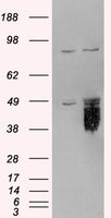 TFPI / LACI Antibody - TFPI antibody staining (0.3 ug/ml) of HeLa lysate (RIPA buffer, 35g total protein cells per lane). Primary incubated for 1 hour. Detected by Western blot of chemiluminescence.