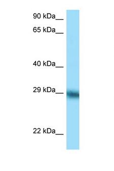 TFPI / LACI Antibody - TFPI antibody Western blot of ACHN Cell lysate. Antibody concentration 1 ug/ml.  This image was taken for the unconjugated form of this product. Other forms have not been tested.