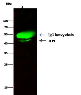 TFPI / LACI Antibody - TFPI was immunoprecipitated using: Lane A: 0.5 mg MCF-7 Whole Cell Lysate. 0.5 uL anti-TFPI rabbit monoclonal antibody and 15 ul of 50% Protein G agarose. Primary antibody: Anti-TFPI rabbit monoclonal antibody, at 1:1000 dilution. Secondary antibody: Dylight 800-labeled antibody to rabbit IgG (H+L), at 1:5000 dilution. Developed using the odssey technique. Performed under reducing conditions. Predicted band size: 35 kDa. Observed band size: 45 kDa.