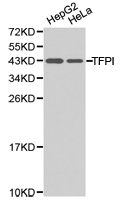 TFPI / LACI Antibody - Western blot of extracts of various cell lines, using TFPI antibody.