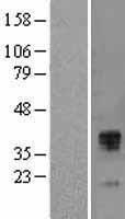 TFPI / LACI Protein - Western validation with an anti-DDK antibody * L: Control HEK293 lysate R: Over-expression lysate