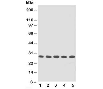 TFPI2 Antibody - Western blot testing of TFPI2 antibody and Lane 1: MM453; 2: MM231; 3: HeLa; 4: HT1080; 5: Jurkat cell lysate
