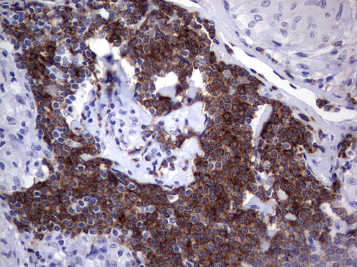 TFPI2 Antibody - Immunohistochemical staining of paraffin-embedded Human lymph node tissue within the normal limits using anti-TFPI2 mouse monoclonal antibody. (Heat-induced epitope retrieval by 1 mM EDTA in 10mM Tris, pH8.5, 120C for 3min,