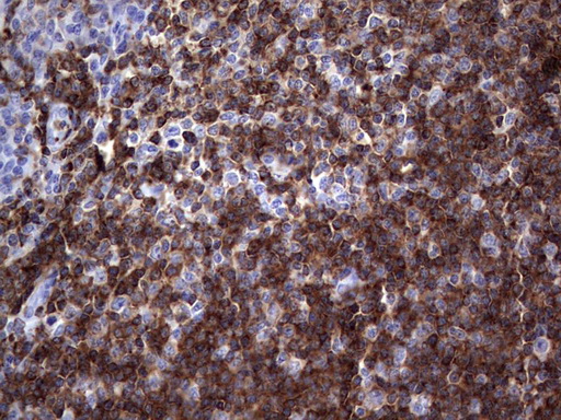 TFPI2 Antibody - Immunohistochemical staining of paraffin-embedded Human tonsil within the normal limits using anti-TFPI2 mouse monoclonal antibody. (Heat-induced epitope retrieval by 1 mM EDTA in 10mM Tris, pH8.5, 120C for 3min,