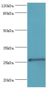 TFPI2 Antibody - Western blot. All lanes: Tissue factor pathway inhibitor 2 antibody at 4 ug/ml+mouse liver tissue. Secondary antibody: Goat polyclonal to rabbit at 1:10000 dilution. Predicted band size: 27 kDa. Observed band size: 27 kDa.