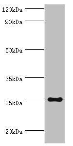 TFPI2 Antibody - Western blot All lanes: factor pathway inhibitor 2 antibody at 4µg/ml + Mouse liver tissue Secondary Goat polyclonal to rabbit IgG at 1/10000 dilution Predicted band size: 27, 26 kDa Observed band size: 27 kDa