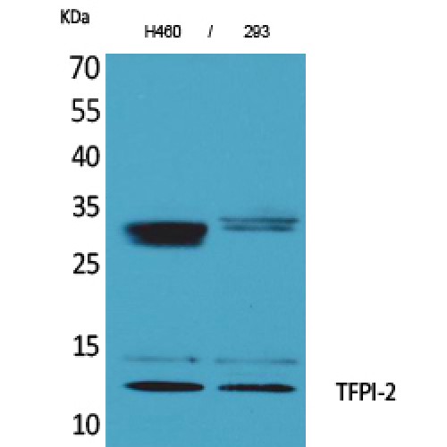 TFPI2 Antibody - Western blot of TFPI-2 antibody