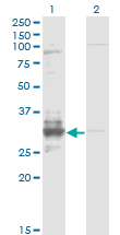 TFPI2 Antibody - Western blot of TFPI2 expression in transfected 293T cell line by TFPI2 monoclonal antibody (M01), clone 3E8.