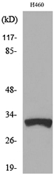 TFPI2 Antibody - Western blot analysis of lysate from H460 cells, using TFPI2 Antibody.