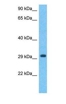 TFPI2 Antibody - Western blot of TFPI2 Antibody with human Fetal Liver lysate.  This image was taken for the unconjugated form of this product. Other forms have not been tested.